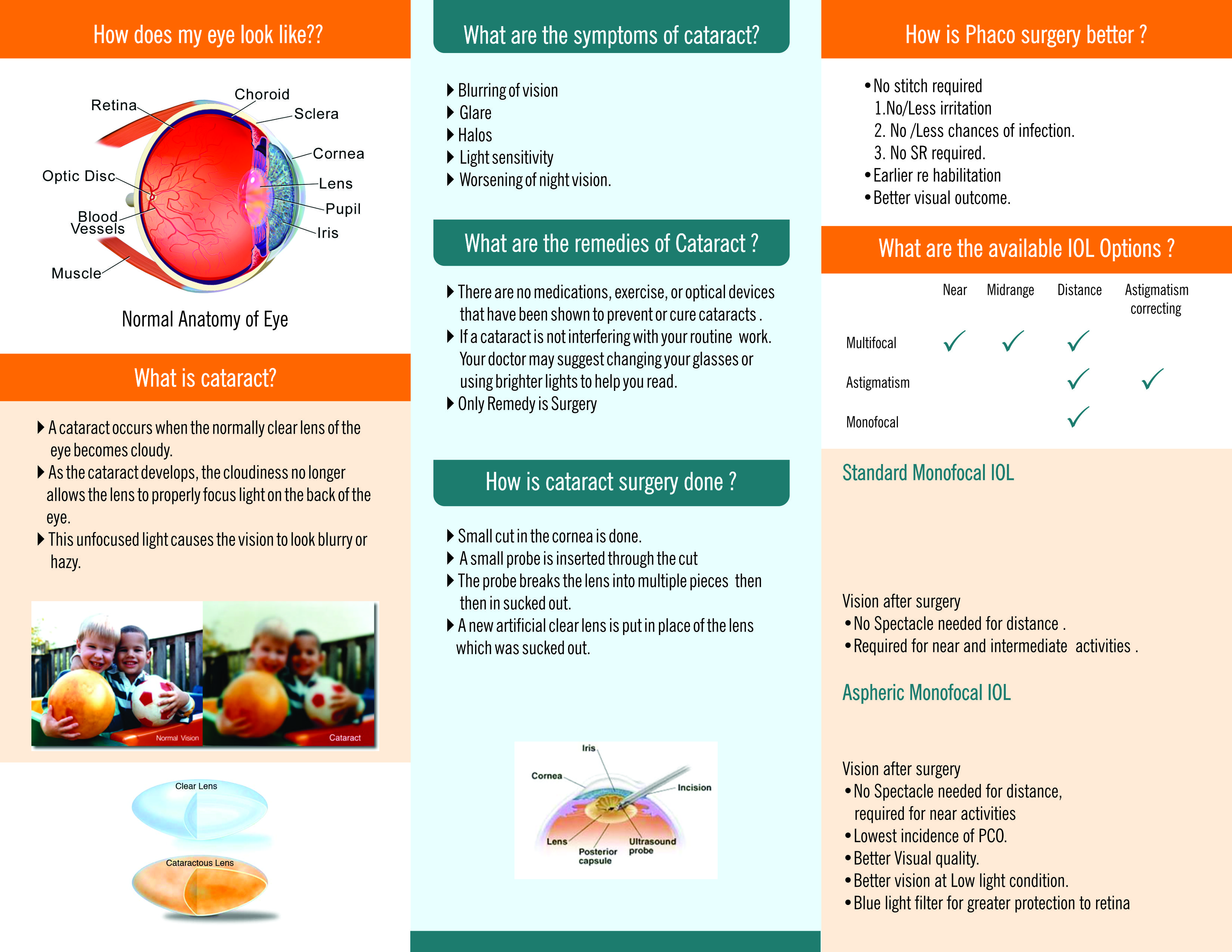 Preview of What Is Cataract? Brochure (Inside)
